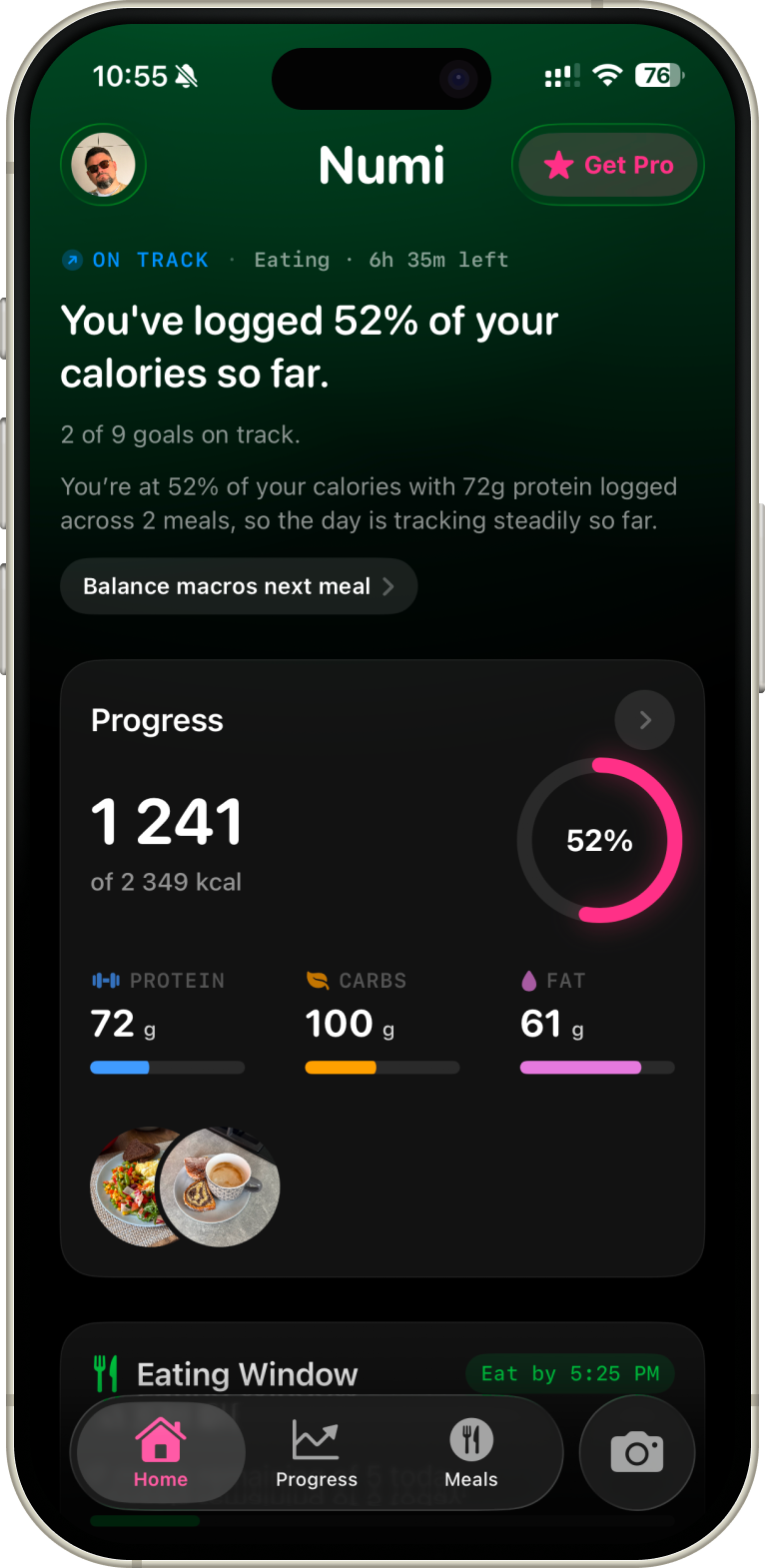 Numi app showing daily progress: 1,241 of 2,349 kcal logged, with macro breakdown and meal photos